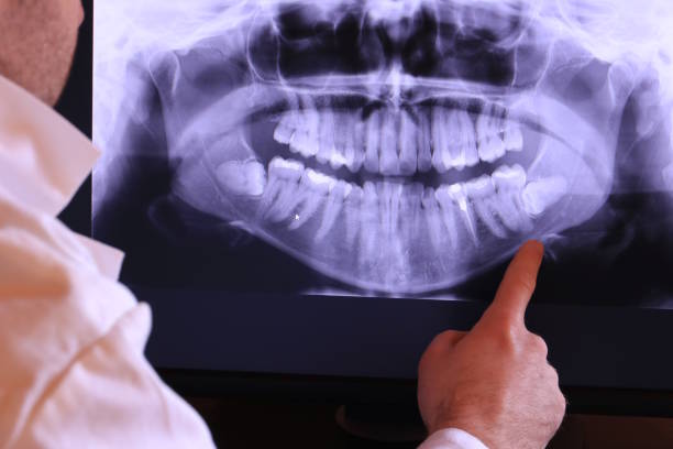 Best Walk-In Emergency Dentist in Perryville, MO