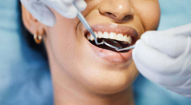 Best Emergency Tooth Extraction in Perryville, MO